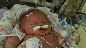 La pequeña Mariana intubada en el hospital