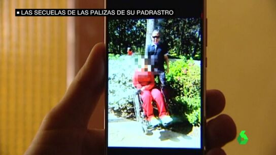 Las secuelas de Alba, la ni&ntilde;a que qued&oacute; tetrapl&eacute;jica por las palizas de su padrastro, una d&eacute;cada despu&eacute;s 