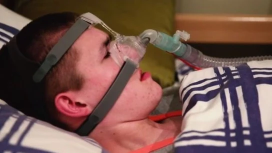 Liam Derbyshire, el joven que morirá si se duerme sin respiración artificial Liam Derbyshire, el joven que morirá si se duerme sin respiración artificial