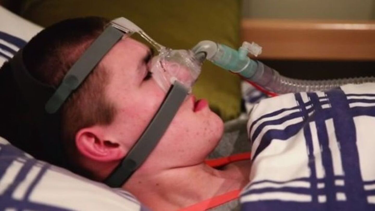 Liam Derbyshire, el joven que morir&aacute; si se duerme sin respiraci&oacute;n artificial 