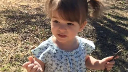 Esta es Eden Carlson, de dos años de edad, después del tratamiento Esta es Eden Carlson, de dos años de edad, después del tratamiento