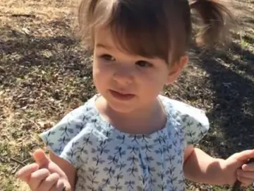 Esta es Eden Carlson, de dos años de edad, después del tratamiento Esta es Eden Carlson, de dos años de edad, después del tratamiento