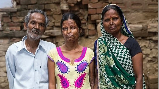 El marido posa junto a su mujer y una de sus hijas a las que roció con ácido El marido posa junto a su mujer y una de sus hijas a las que roció con ácido