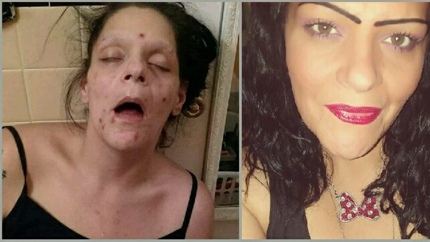 El antes y el después de Marisa Lee Matos El antes y el después de Marisa Lee Matos