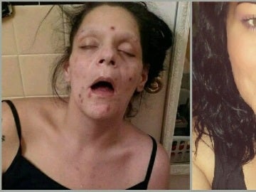 El antes y el después de Marisa Lee Matos El antes y el después de Marisa Lee Matos
