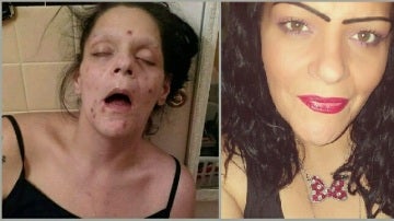 El antes y el después de Marisa Lee Matos