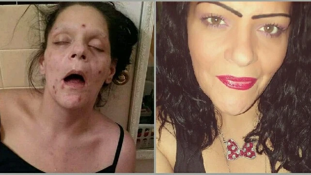 El antes y el después de Marisa Lee Matos