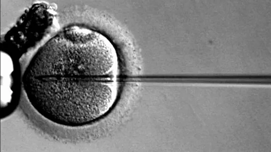 Fecundación in vitro Fecundación in vitro