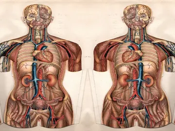 Situs inversus Situs inversus