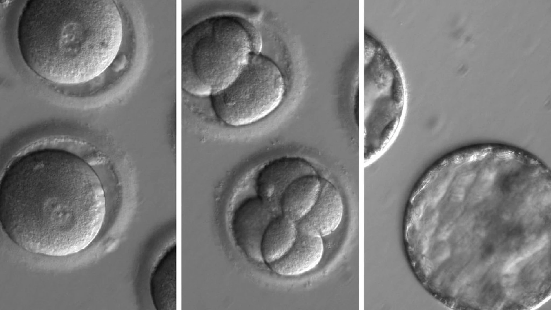 Embriones humanos a los que se aplicó la técnica CRISPR (Archivo)