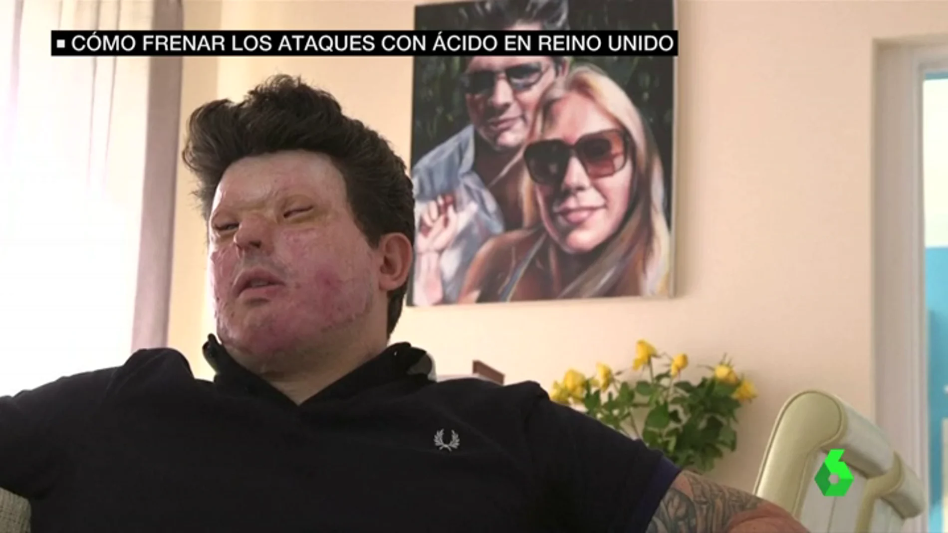 Andreas Christopheros víctima de un ataque con ácido