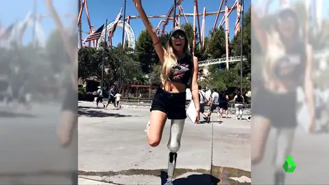 Manchas, estrías, curvas, vello... el fenómeno 'Body Positive' rompe con la presión estética de la sociedad Manchas, estrías, curvas, vello... el fenómeno 'Body Positive' rompe con la presión estética de la sociedad