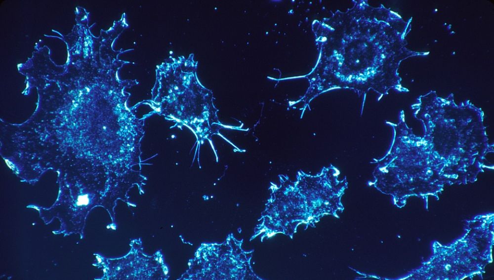 Imagen de archivo de células cancerosas