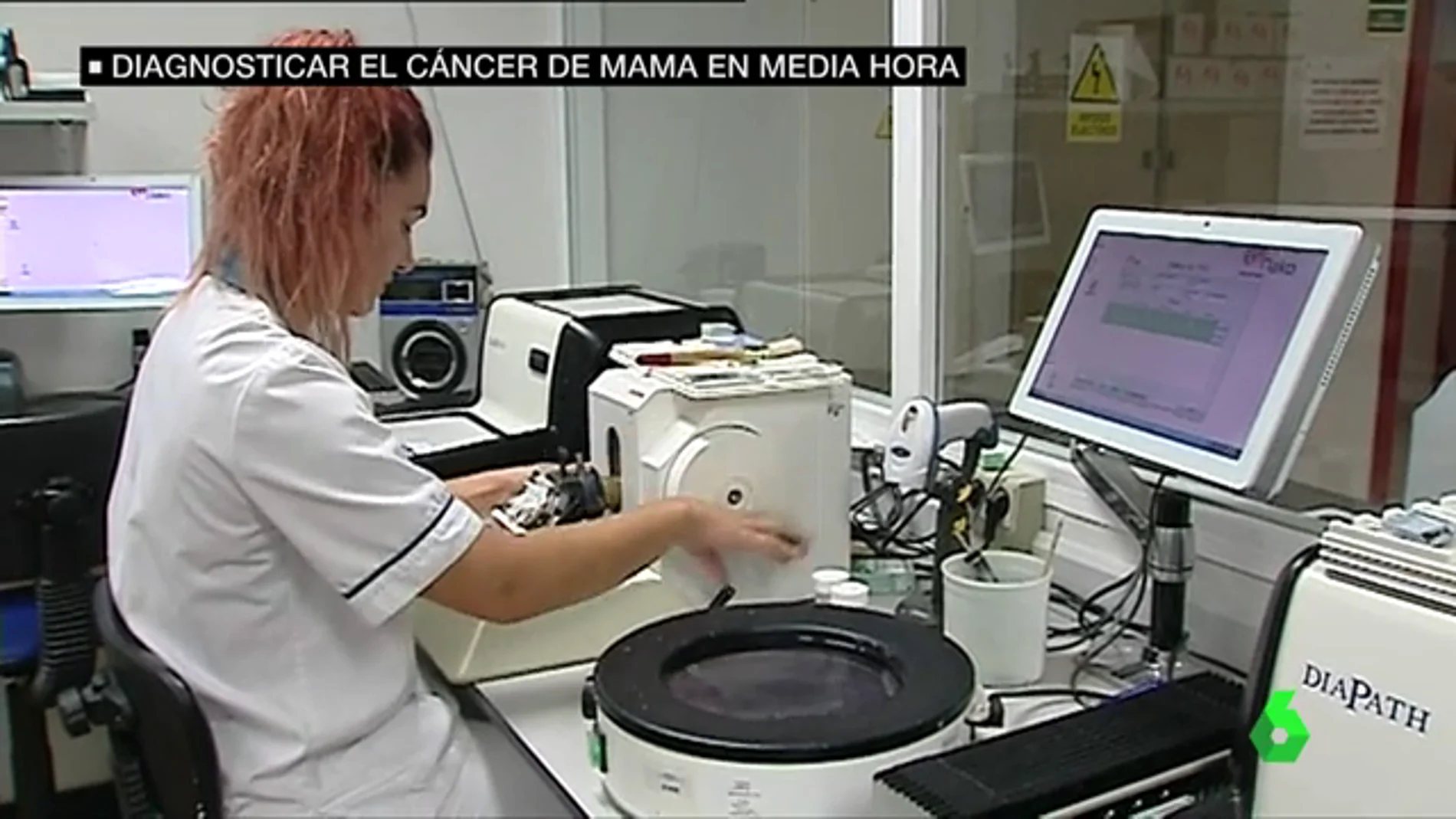 'La biopsia rápida', un nuevo sistema que permite identificar el cáncer de mama en 30 minutos