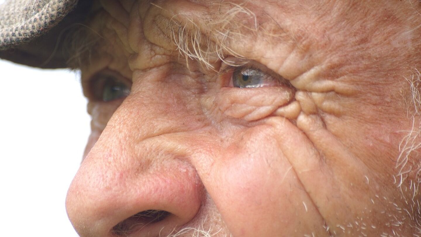 El Alzheimer se podr&iacute;a detectar a trav&eacute;s de los ojos