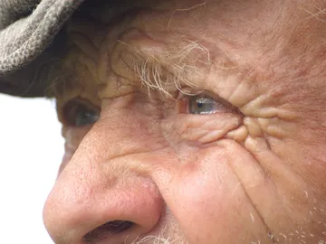 El Alzheimer se podría detectar a través de los ojos El Alzheimer se podría detectar a través de los ojos