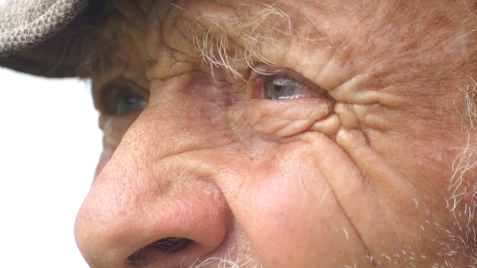 El Alzheimer se podría detectar a través de los ojos
