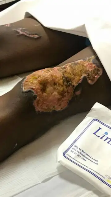 La joven ha sufrido heridas por todo su cuerpo La joven ha sufrido heridas por todo su cuerpo