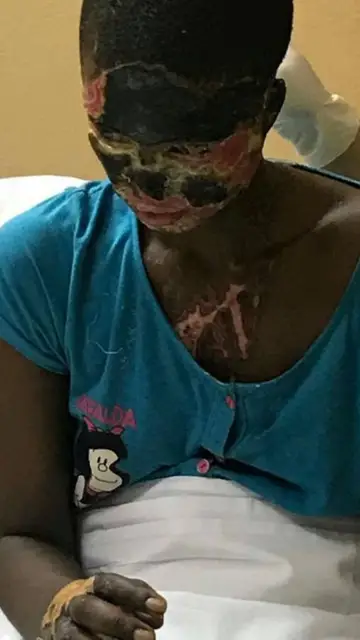 Atsede sigue ingresada recuperándose de las heridas Atsede sigue ingresada recuperándose de las heridas