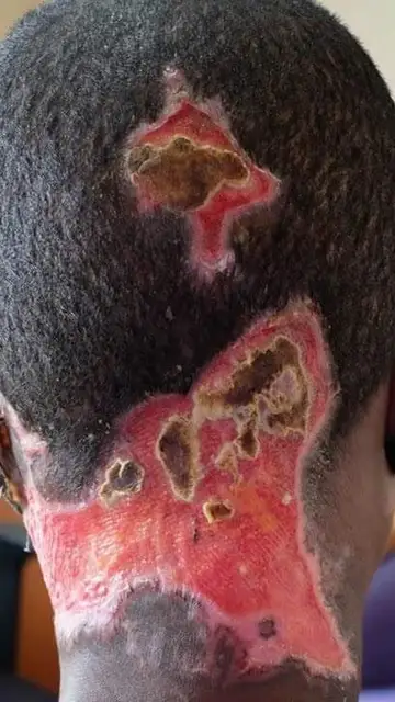 Atsede de espaldas Atsede de espaldas