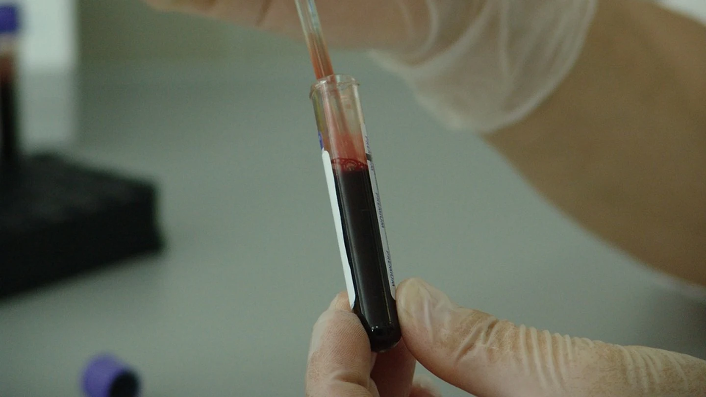 Un análisis de sangre Un análisis de sangre podrá detectar el cáncer de páncreas
