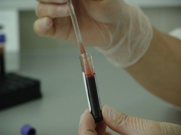 Un análisis de sangre Un análisis de sangre