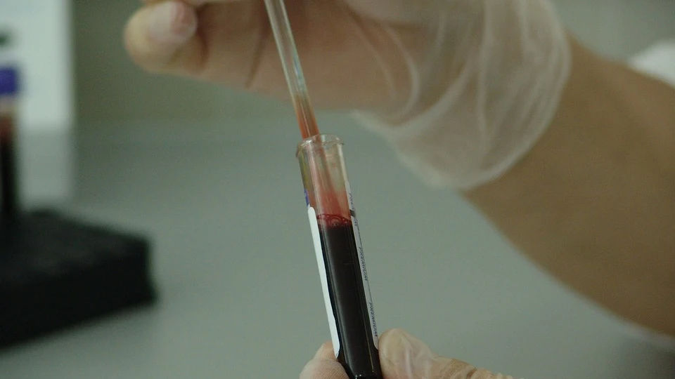 Un análisis de sangre Un análisis de sangre podrá detectar el cáncer de páncreas