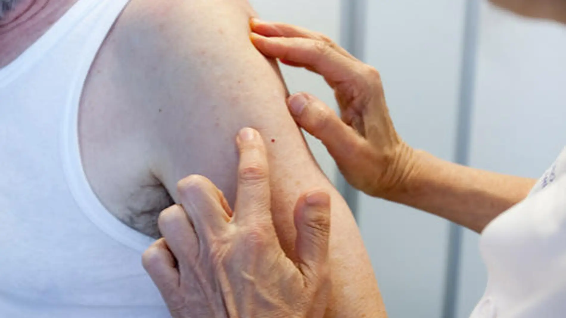 Dos estudios arrojan resultados positivos en pacientes con melanoma