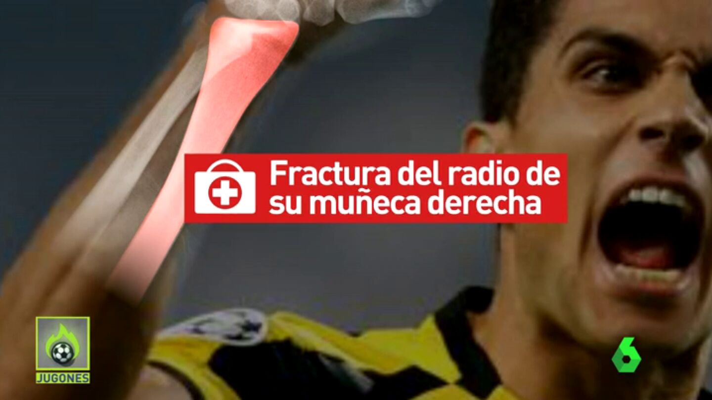 Marc Bartra recuerda el atentado en Dortmund que le cambi&oacute; la vida
