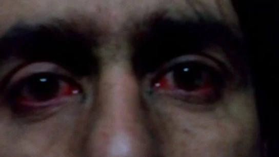La terrible cara después de tener el fuego cara a cara La terrible cara después de tener el fuego cara a cara