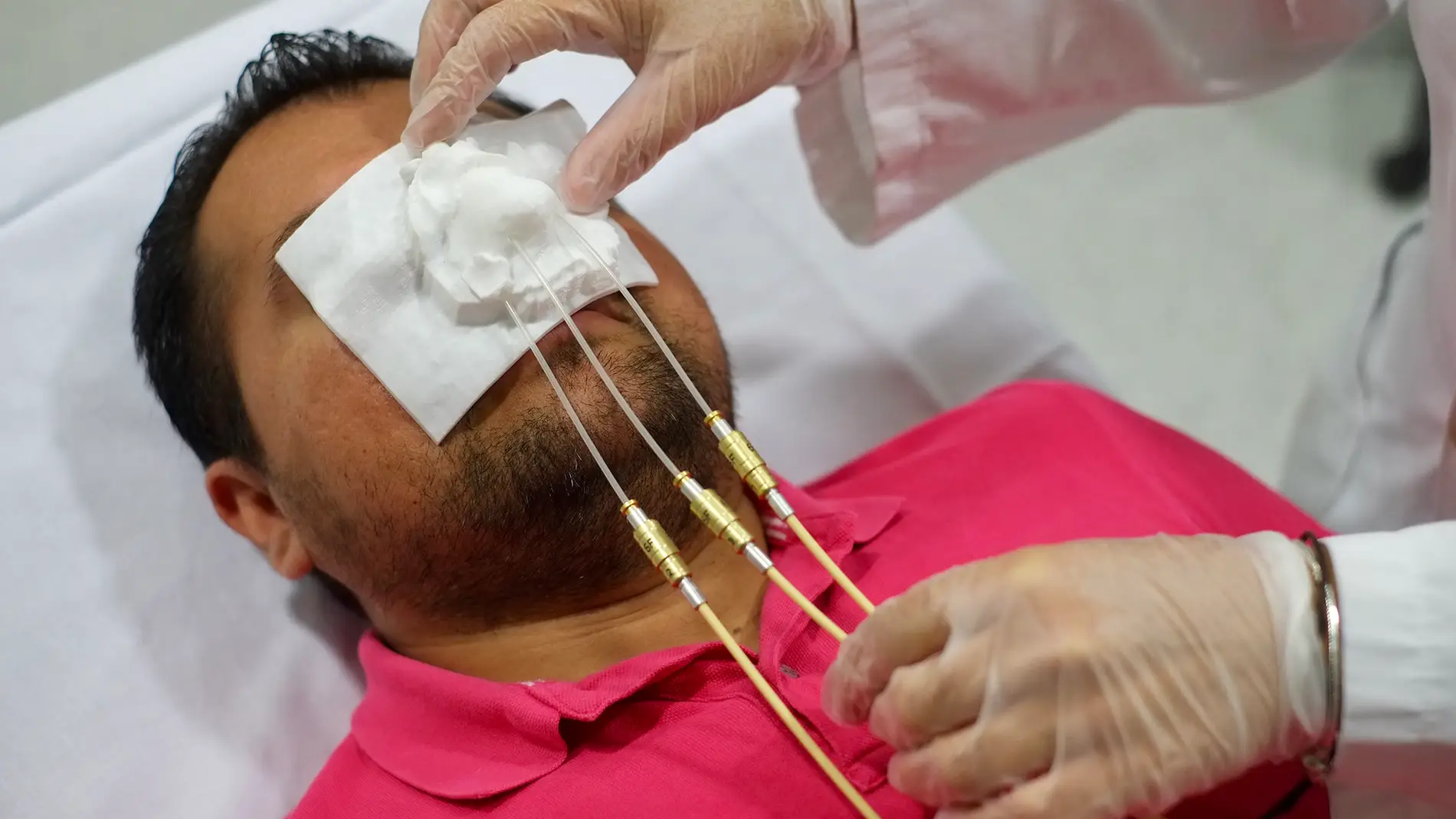 Impresion 3D para proteger la piel en el tratamiento del cancer
