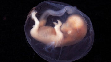 La tecnica de los tres padres geneticos es eficaz en problemas de infertilidad