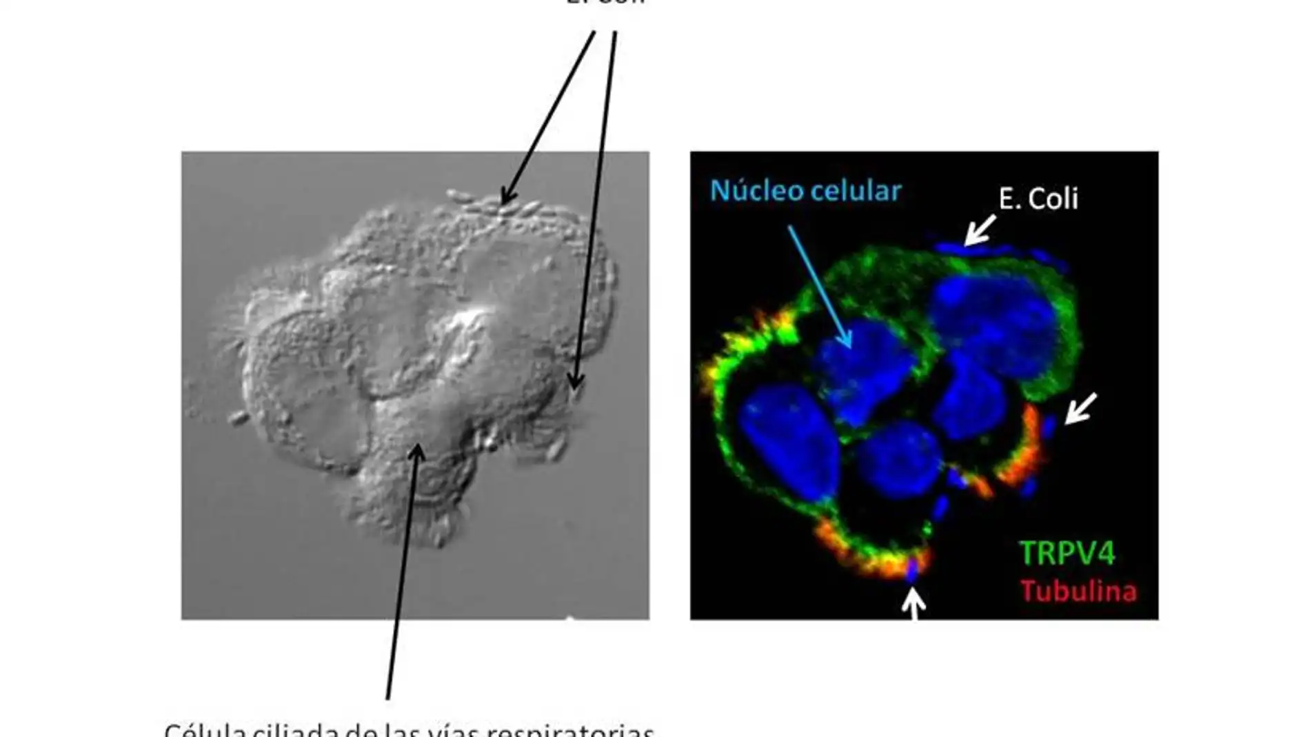 Ataque de bacterias escherichia coli a las células ciliadas del pulmón - UPF