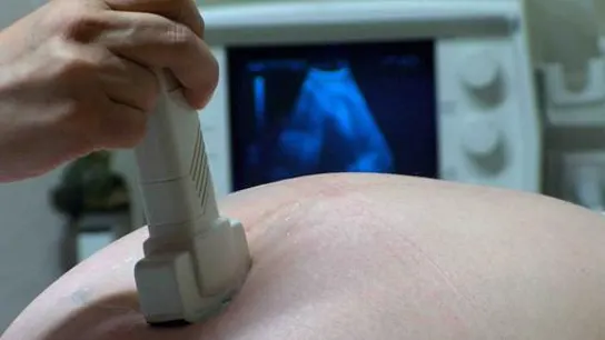 Imagen de archivo de una ecografía Imagen de archivo de una ecografía