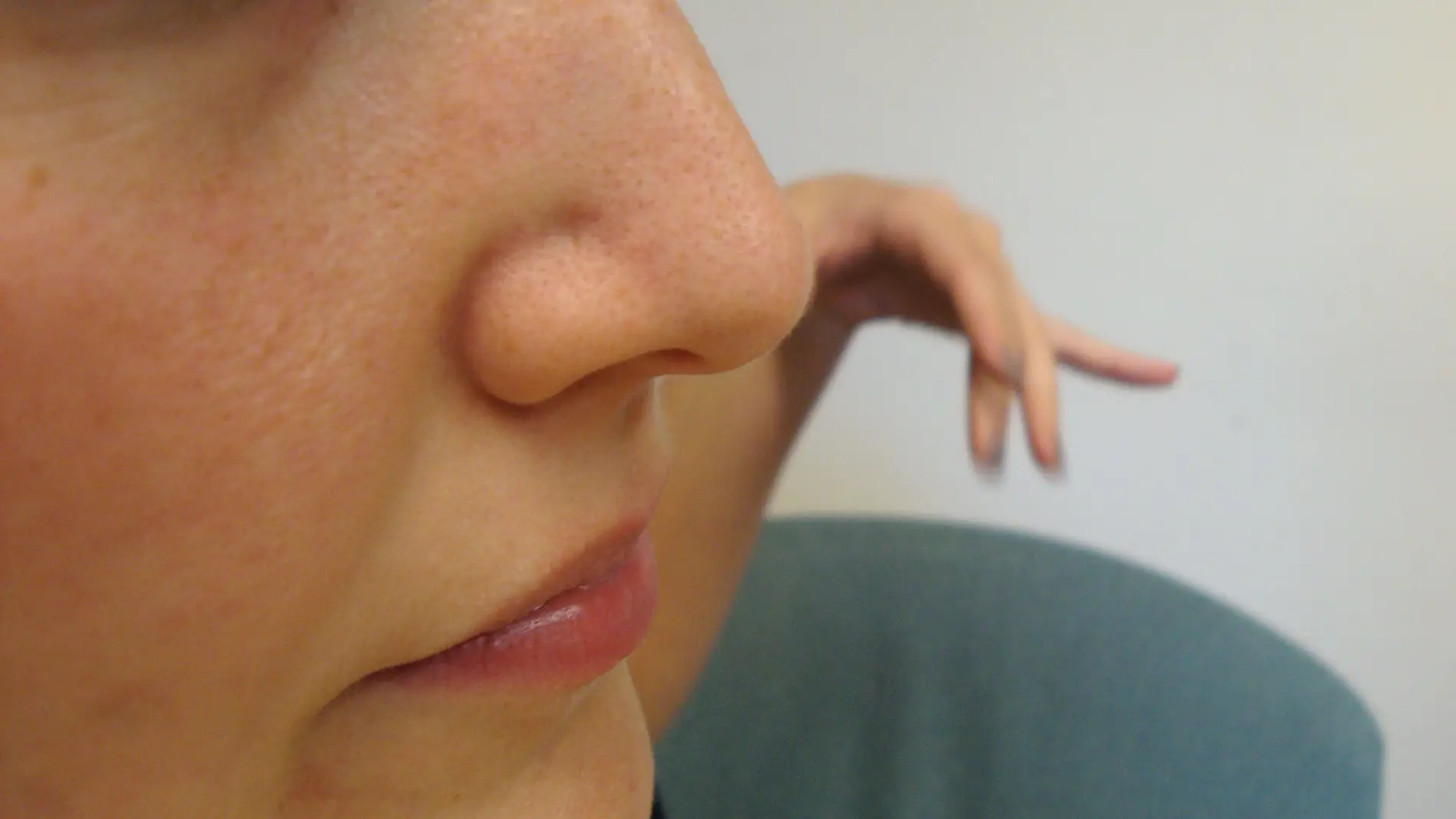Es posible que un diente extra termine creciendo en tu nariz