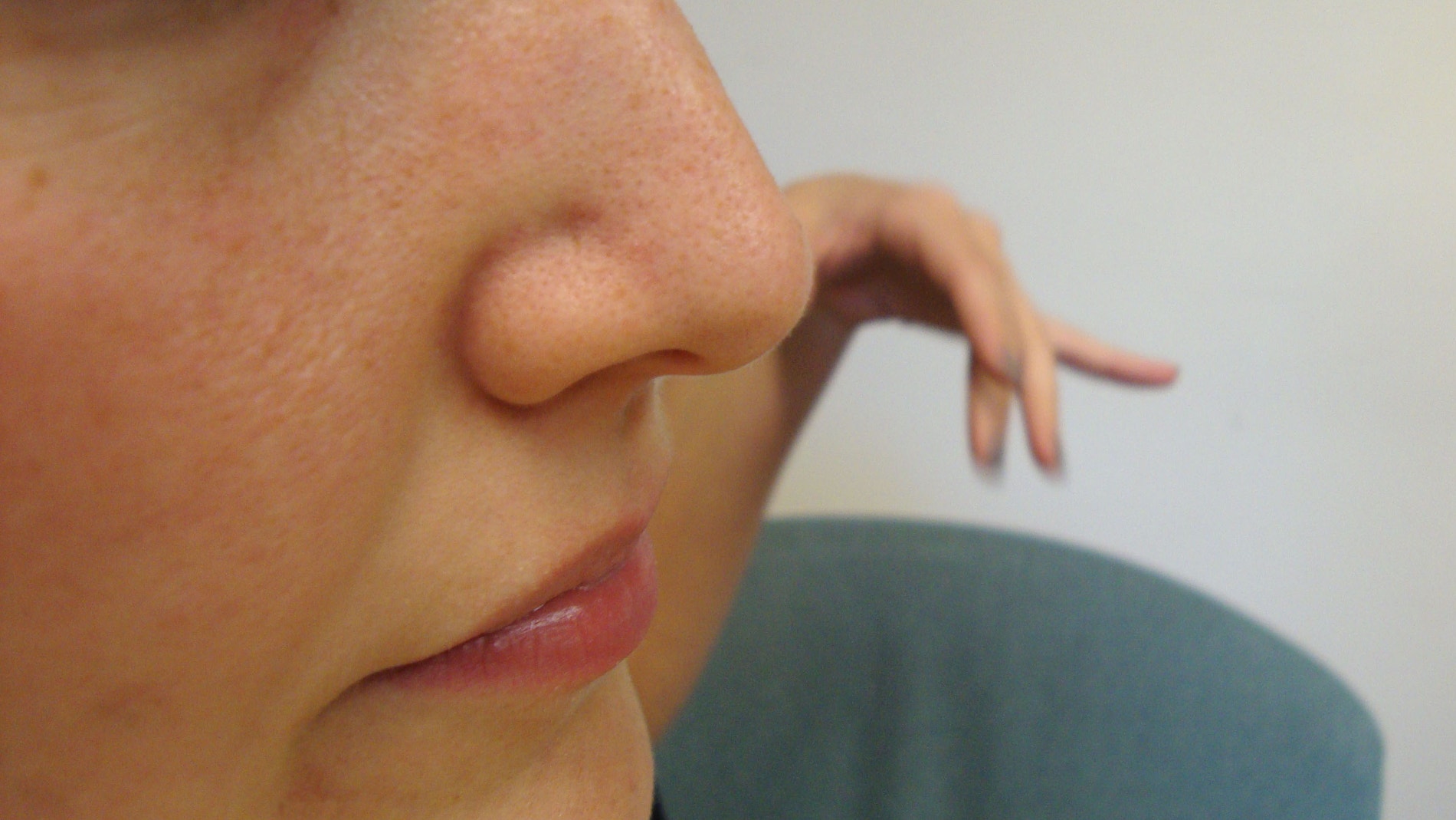 Es posible que un diente extra termine creciendo en tu nariz