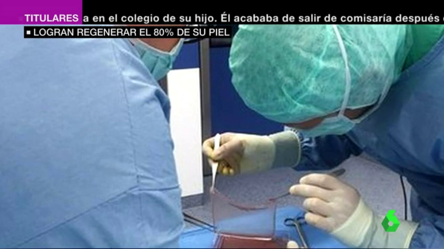 Una terapia gen&eacute;tica salva la vida de un ni&ntilde;o con una enfermedad rara en la piel