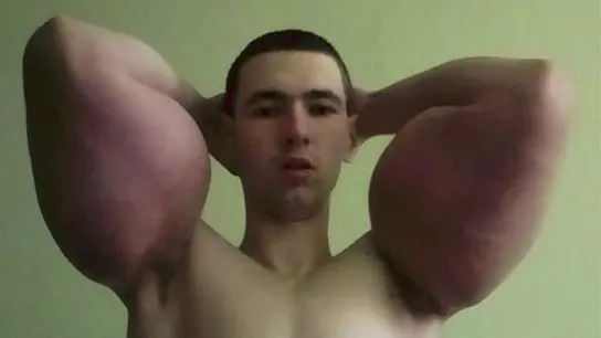 Kirill Tereshin, más conocido como el 'Popeye ruso' Kirill Tereshin, más conocido como el 'Popeye ruso'