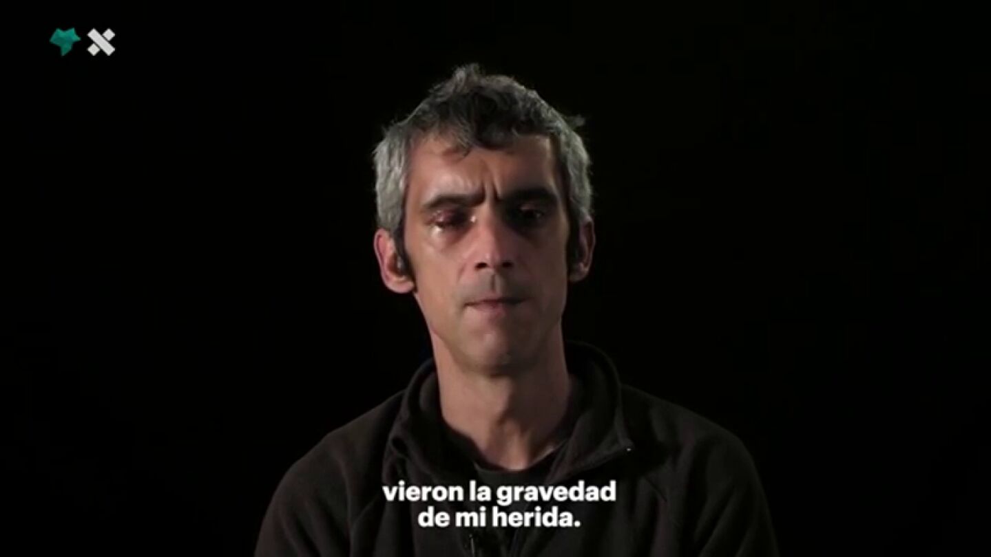El hombre que perdi&oacute; la visi&oacute;n de un ojo el 1 de octubre, Roger Espa&ntilde;ol