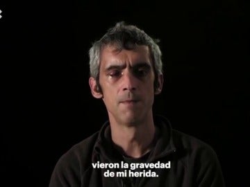 El hombre que perdió la visión de un ojo el 1 de octubre, Roger Español El hombre que perdió la visión de un ojo el 1 de octubre, Roger Español