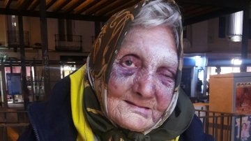 La anciana agredida por varias personas en Madrid.