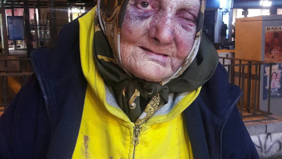 La anciana agredida por varias personas en Madrid.