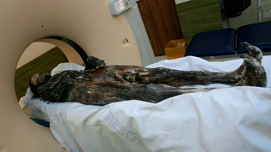 TAC a una momia TAC a una momia