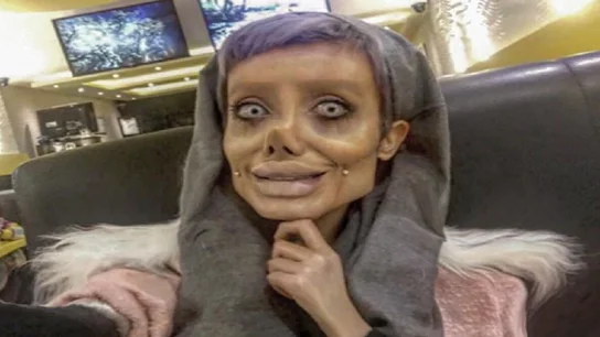 Sahar Tabar, la joven que quería parecerse a Angelina Jolie Sahar Tabar, la joven que quería parecerse a Angelina Jolie