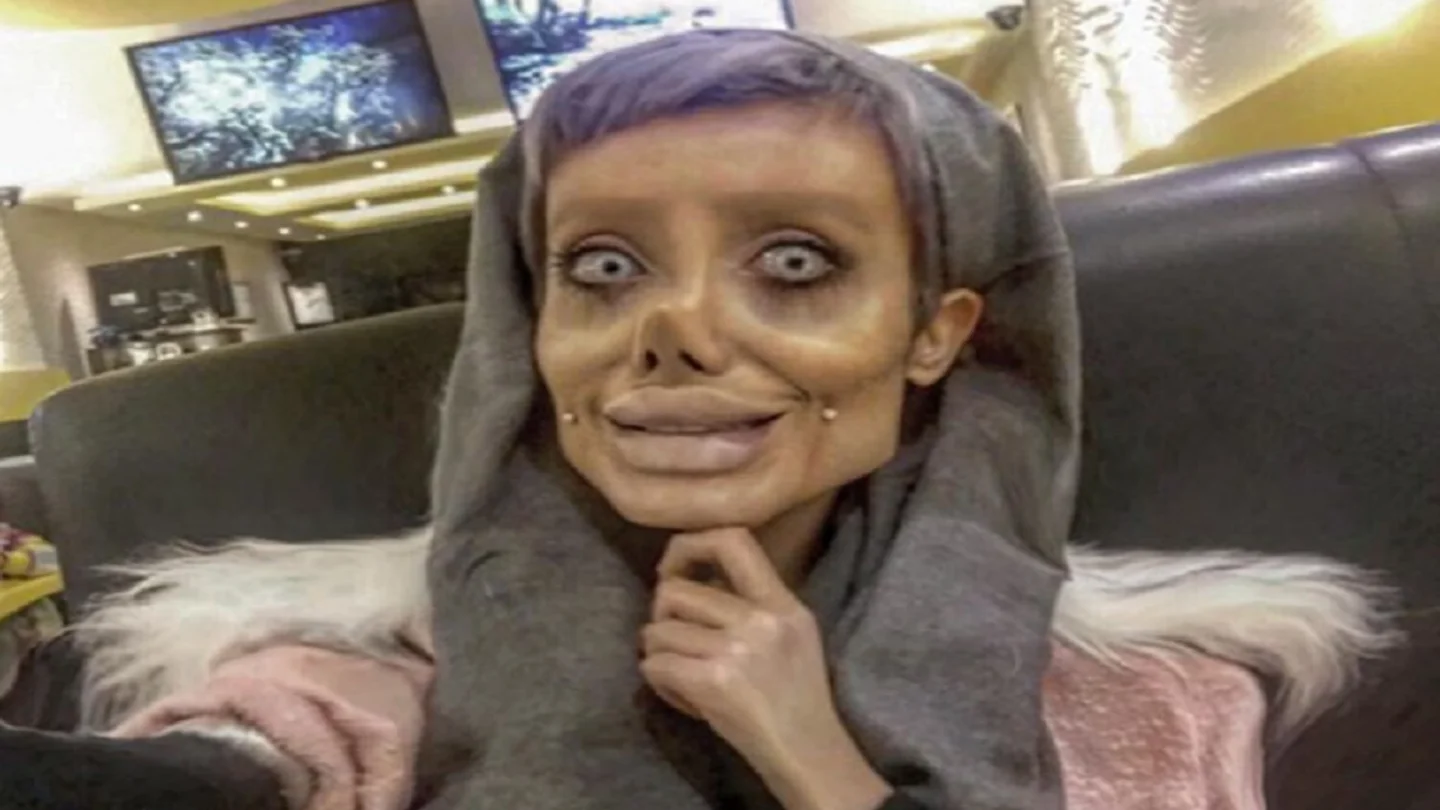 Sahar Tabar, la joven que quería parecerse a Angelina Jolie Sahar Tabar, la joven que quería parecerse a Angelina Jolie