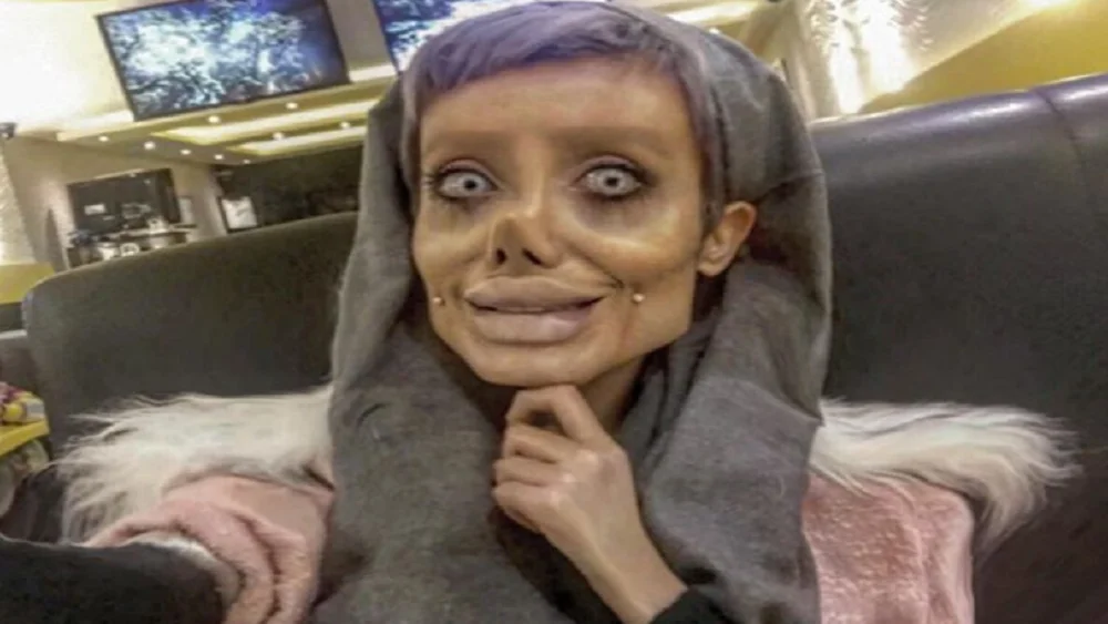Sahar Tabar, la joven que quería parecerse a Angelina Jolie Sahar Tabar, la joven que quería parecerse a Angelina Jolie