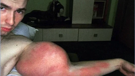 Uno de los bíceps del 'Popeye ruso' Uno de los bíceps del 'Popeye ruso'