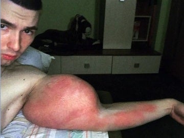 Uno de los bíceps del 'Popeye ruso' Uno de los bíceps del 'Popeye ruso'