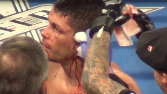 Le parten la oreja a Stephen Smith en un combate Le parten la oreja a Stephen Smith en un combate