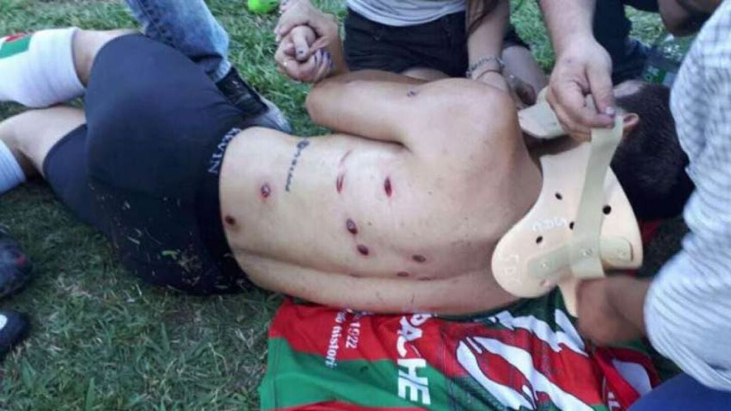 jugador del Sportivo Las Parejas tras la batalla campal